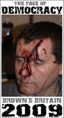 tony ward injured tony ward injured