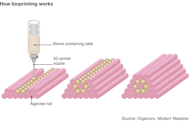 bioprinting