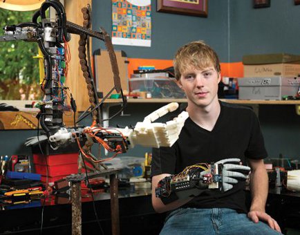 prosthetic-arm